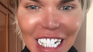 Živý Ken v rozklade. V noci mu vypadávajú zuby