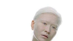 Holá hlava, pehy a kypré tvary: 10 modeliek ako dôkaz toho, že byť dokonalý je nuda