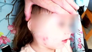 V známej dovolenkovej destinácii sa premnožili komáre. Môžu prenášať závažnú chorobu?