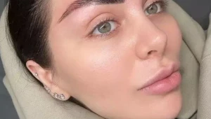 Nechcela si ho vytetovať ani denne maľovať: Rozhodla pre transplantáciu obočia, takto TO dopadlo