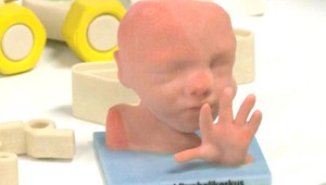 Vytlačte si svoje dieťa ešte pred narodením