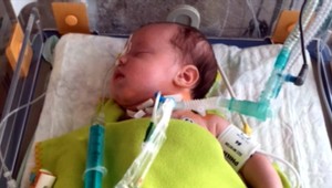Trojmesačnému Máriovi sa po operácii darí, čaká ho ale ďalšia