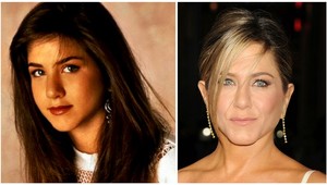 Celebrity s plastikou nosa: Na fotkách z mladosti ich nespoznáte!