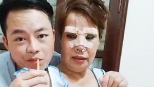 Zbalil ju mladý zajačik, podstúpila niekoľko zákrokov: Odpadnete, ako dnes babička vyzerá