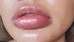 Už aj ona podľahla botoxu?! Kráska tvrdí, že je to niečo úplne iné!