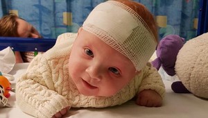 Hororové fotky novorodenca: Pozrite sa, čo mu spôsobilo znamienko