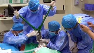 Dievča (2) spadlo na nožnice. Z lebky mu ich museli dostať hasičskými kliešťami