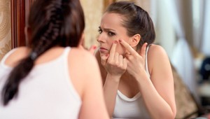 Dajte akné zbohom navždy! 5 tipov, ktoré vám zlepšia pleť už počas noci