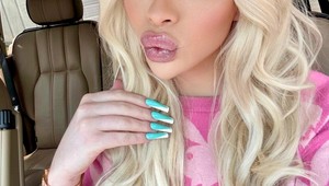 Minula tisíce na plastiky, aby vyzerala ako Marilyn Monroe: Teraz túži vyzerať ako predtým