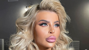 Ceterová láka sledovateľky do Turecka na najnebezpečnejšiu z plastických operácií!