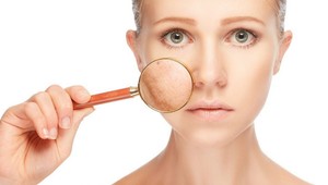 Pribudli vám pigmentové fľaky? Zbavte sa ich jednoduchou prírodnou metódou