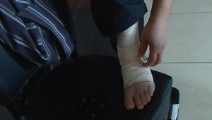 Nedrží váš členok pri chôdzi?  Budete prekvapení, čo vám pomôže!