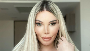 Predtým Ken, dnes už Barbie šokuje po zmene pohlavia ďalšou veľkou operáciou! Inak to už nezvládne!