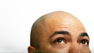 Už onedlho by môžzeme mať liek na plešatenie. Vedci už vedia, kde je chyba