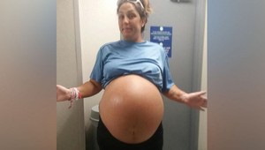 Novorodenec vyrazil doktorom dych: Takéto dieťa v pôrodnici ešte nemali