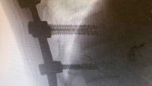 Neurochirurg varuje: Rodičia, nedovoľte deťom skákať hlavičky do záhradných bazénov!