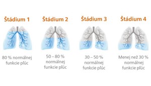 Rozdýchavate dlhšie, ako je zdravé?