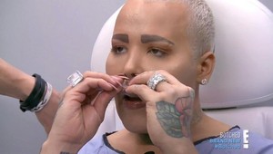 Je posadnutý plastikami, má ich vyše 50: Jordan túži po najväčších mužských perách