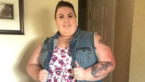 Mladá žena zhodila 105 kíl! Pozrite sa, ako jej rapídne schudnutie zmenilo tvár!