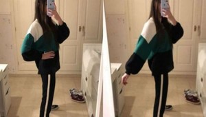 Bizarná optická ilúzia valcuje internet: Je na obrázku len jedna noha alebo dve?