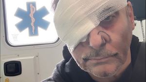 Hrôza počas predstavenia! Slovenskú muzikálovú hviezdu oštep takmer pripravil o oko!