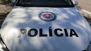 Súčasťou výbavy policajtov bude aj paralyzér. Nesprávne použitie môže ohroziť život