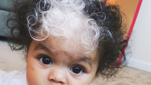 Bábätko s jedinečným dedičstvom