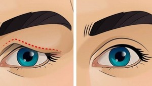 Super TRIK, ktorý vás zbaví ovisnutých očných viečok: Výsledok uvidíte hneď!