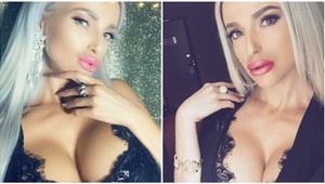 Rozišla sa s frajerom kvôli bitke? Zuzanita otvorene prehovorila o násilných mužoch!