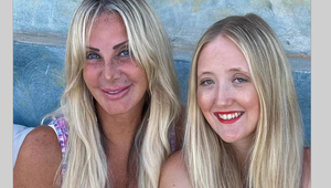 Matka minula pol milióna eur, aby vyzerala mladšie ako jej dcéra: Toto je výsledok!