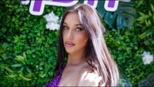 FOTO: Bianka Rumanová sa ukázala po plastike nosa: TAKTO vyzerá po zákroku!