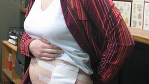 V Anglicku transplantovali obličku 8 -ročnému divčatku: Nebude musieť užívať celý život lieky na potláčanie imunity!