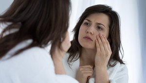 Trápia vás kruhy pod očami? Odhaľte príčinu a odstráňte ju!