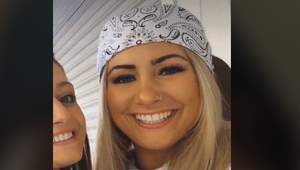 Po tom, ako si pery nechala napichať, zažila šok: Ústa jej giganticky napuchli cez polovicu tváre