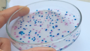 Ľudia sú odolnejší voči ATB. Ako strava dokáže ovplyvniť účinnosť antibiotík?