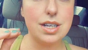 Rachel prišla o oko, ale svoj hendikep neskrýva: Wau, jej tvár vás určite nevydesí!