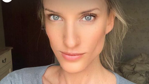 Adela Vinczeová zverejnila fotku svojej tváre, vôbec ale nečakala, ČO bude nasledovať!