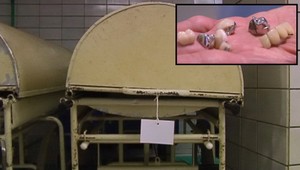 V Trenčianskej nemocnici zmizli zlaté zuby