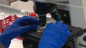 Umelé oplodnenie s vyšetrenými embryami? Pre Slovákov nedostupný luxus