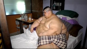 Najobéznejší muž planéty vážil takmer 600 kíl, operácia mu zmení život