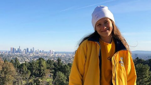 Šesť rokov si neumývala vlasy: Povedali by ste to o nej?