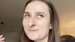 Po rokoch sa odhodlala na operáciu nosa: Po premene je z nej brutálna kočka