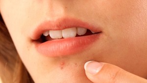 Ustavične sa bojíte o svoje zdravie? Zrejme máte nozofóbiu