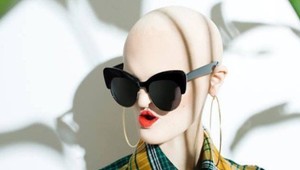 Myslela, že skončí ako samotárka. Teraz je z nej úspešná modelka