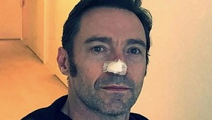 Šesť operácií! Hollywoodska hviezda bojuje so zhubným nádorom