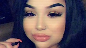 Chcela ušetriť na zväčšení pier, takto TO dopadlo: FOTO len pre silnejšie povahy!