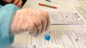 Celoplošné testovanie: Nákup antigénových testov bol v súlade so zákonom