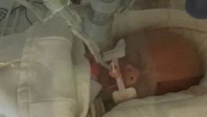 Dieťa, ktorého matka uprednostnila pôrod pred chemoterapiou, zomrelo