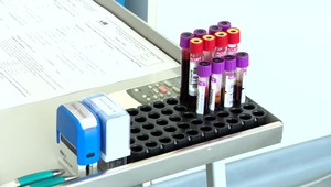 Darovanie krvi môže zachrániť životy: Jedna skupina je kriticky nízka