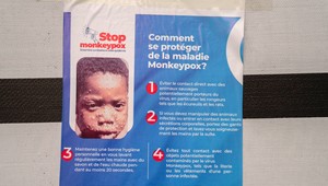 WHO vyhlásila stav ohrozenia: Epidémia opičích kiahní už v Európe!